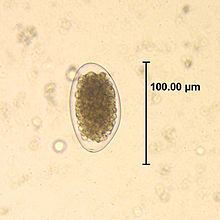 Life cycle of Babesia microti